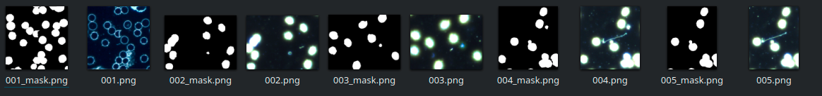 Figure 1: Examples of dark-field microscopy images and their corresponding masks.