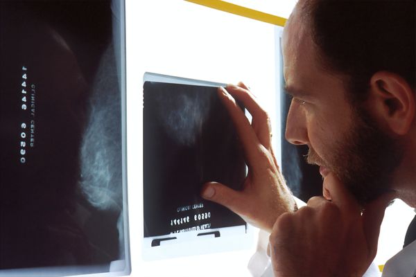 Use Case: Classifying Chest X-Rays to Detect Pneumonia