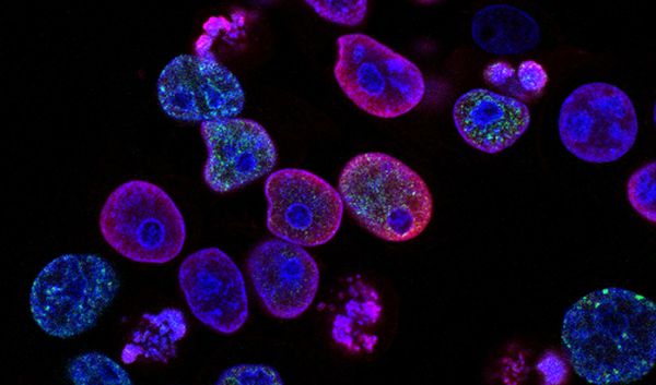 Use Case: Highlighting Blood Cells in Dark-field Microscopy Using Image Segmentation